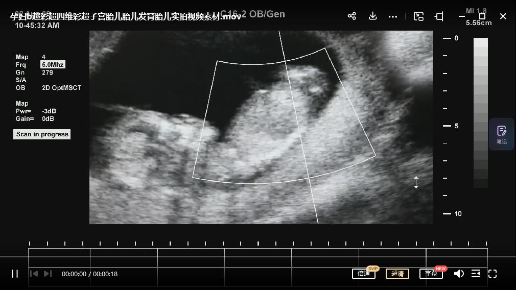 图片[3]-最新抖音快手蓝海无人直播胎教助眠玩法，轻松引爆直播间【教程+软件+素材】-臭虾米项目网