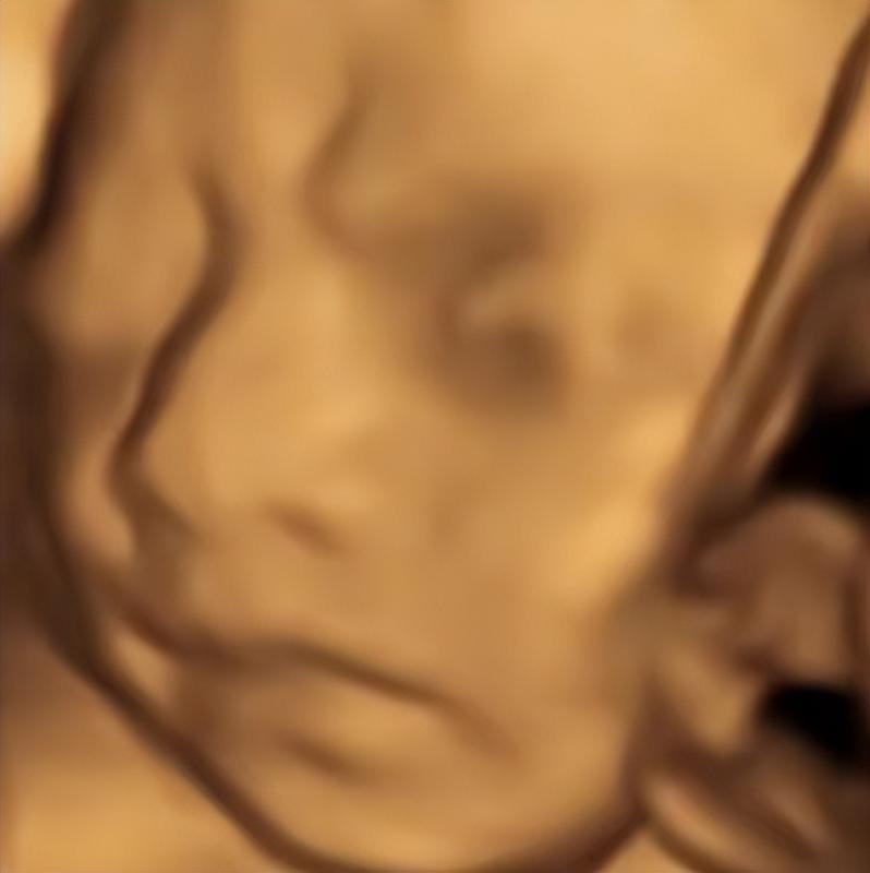 AI四维彩超预测,一单9.9-98,3分钟出图,一天变现1000+【揭秘】